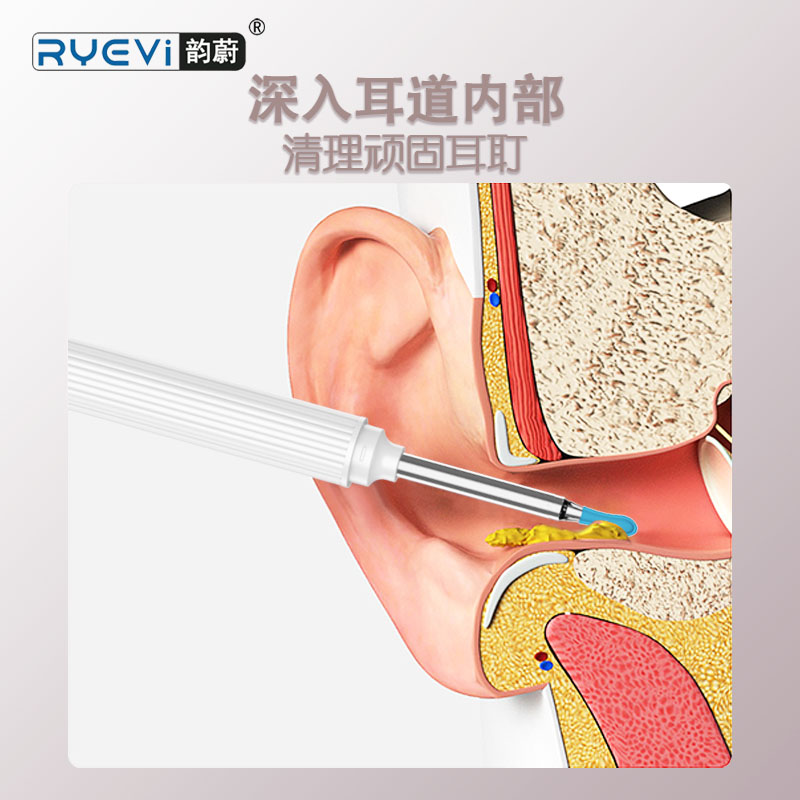 YW12智能可视采耳器