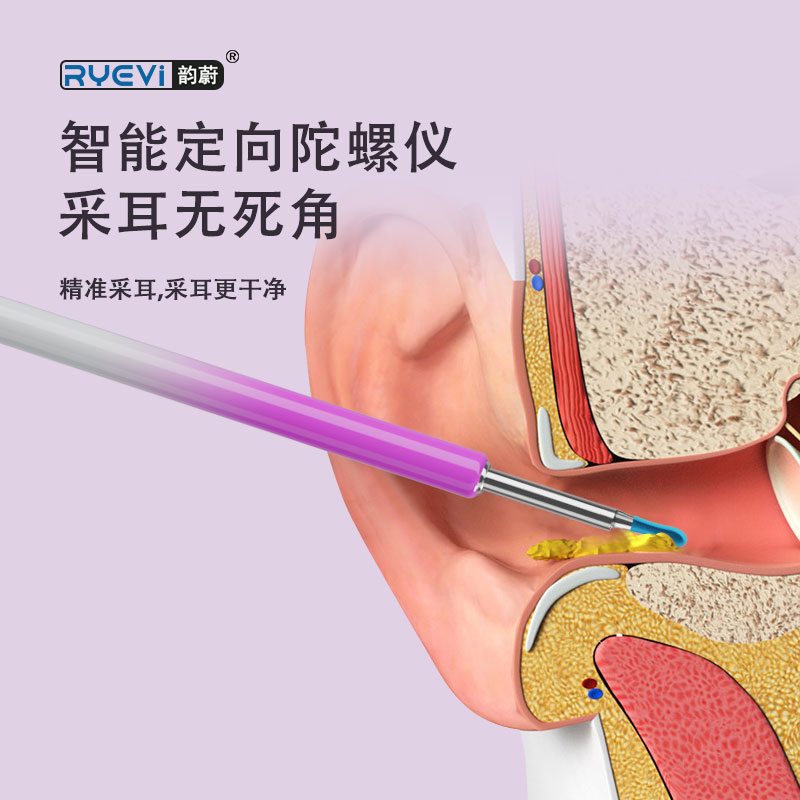 RV-007 智能可视采耳器
